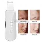 Ultrasonic Facial Scrubber